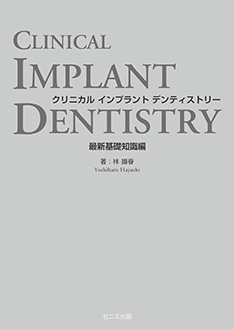 クリニカル インプラント デンティストリー 最新基礎知識編｜ゼニス出版