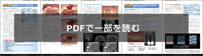 CLINICAL IMPLANT DENTISTRY