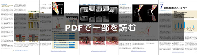 エビデンスに基づいた最新インプラント治療マニュアル