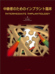 中級者のためのインプラント臨床