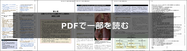 口腔インプラント治療と上顎洞合併症