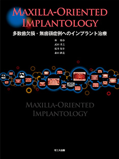 Maxilla-Oriented Implantology 多数歯欠損・無歯顎症例へのインプラント治療