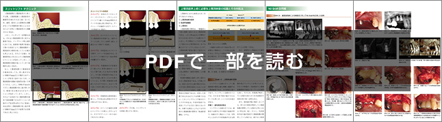 インプラント治療　難症例攻略テクニック