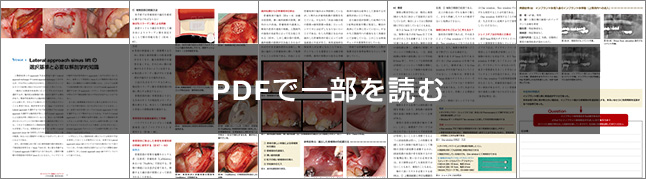 サイナスリフト　実践ルールブック トラブルを回避・解決するために