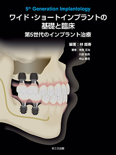 ワイド・ショートインプラントの基礎と臨床 第5世代のインプラント治療