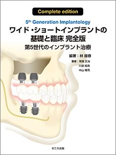 ワイド・ショートインプラントの基礎と臨床 完全版 第5世代のインプラント治療