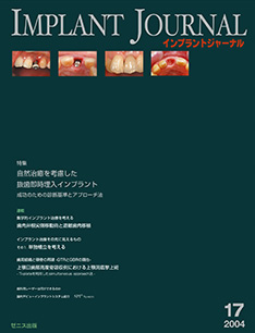 IMPLANT JOURNAL