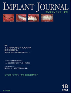 IMPLANT JOURNAL