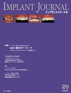 IMPLANT JOURNAL