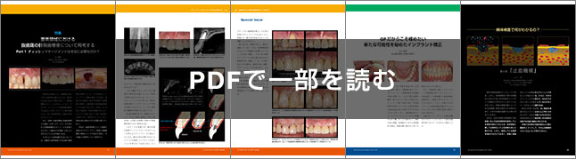 IMPLANT JOURNAL