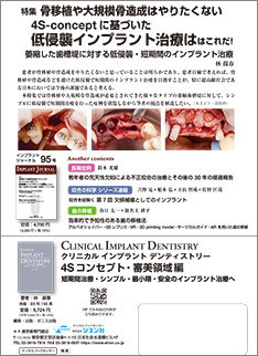 IMPLANT JOURNAL インプラントジャーナル 最新号｜ゼニス出版