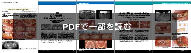 IMPLANT JOURNAL