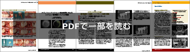 IMPLANT JOURNAL