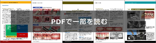インプラントジャーナル IMPLANT JOURNAL 107号 | ゼニス出版